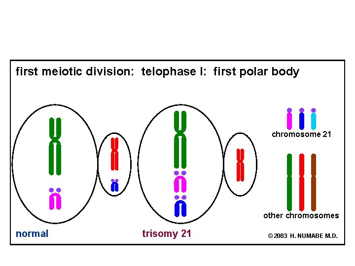 first meiotic division: telophase I: first polar body chromosome 21 other chromosomes normal trisomy