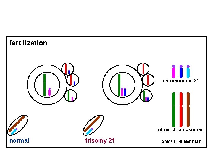 fertilization chromosome 21 other chromosomes normal trisomy 21 © 2003 H. NUMABE M. D.