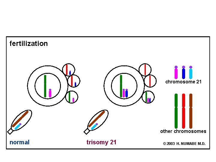 fertilization chromosome 21 other chromosomes normal trisomy 21 © 2003 H. NUMABE M. D.