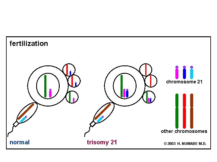 fertilization chromosome 21 other chromosomes normal trisomy 21 © 2003 H. NUMABE M. D.