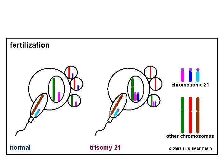 fertilization chromosome 21 other chromosomes normal trisomy 21 © 2003 H. NUMABE M. D.