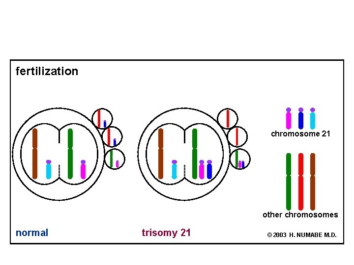 fertilization chromosome 21 other chromosomes normal trisomy 21 © 2003 H. NUMABE M. D.