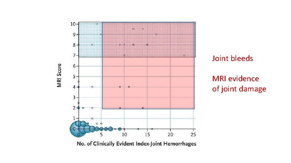 Joint bleeds MRI evidence of joint damage 