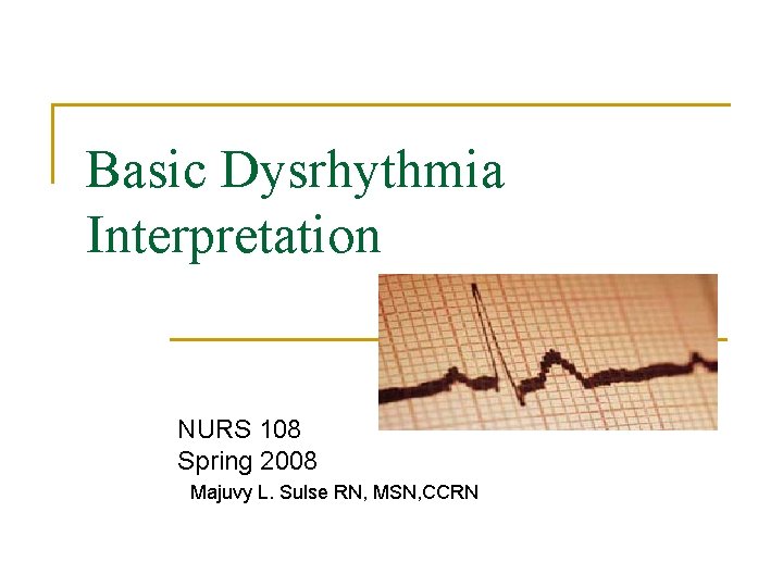 Basic Dysrhythmia Interpretation NURS 108 Spring 2008 Majuvy L. Sulse RN, MSN, CCRN 