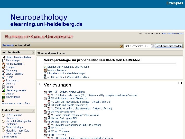 Examples Neuropathology elearning. uni-heidelberg. de 