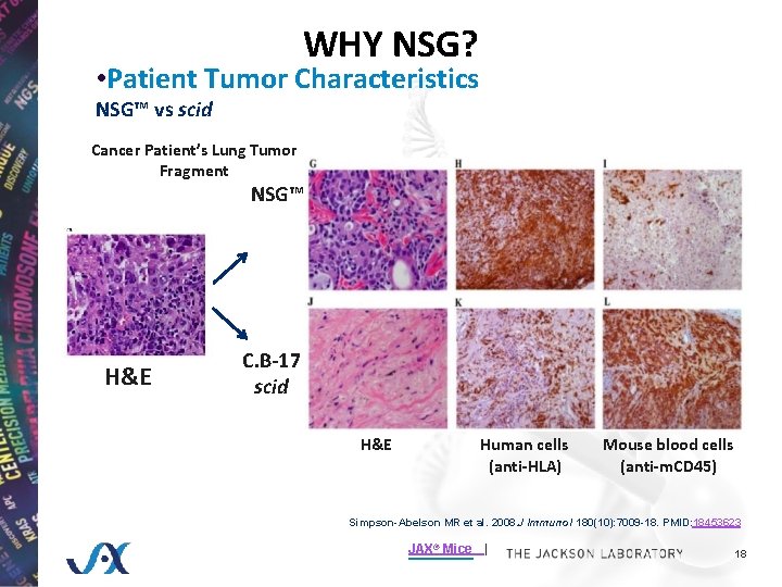 WHY NSG? • Patient Tumor Characteristics NSG™ vs scid Cancer Patient’s Lung Tumor Fragment