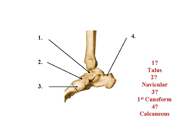 1. 2. 3. 4. 1? Talus 2? Navicular 3? 1 st Cuneform 4? Calcaneous