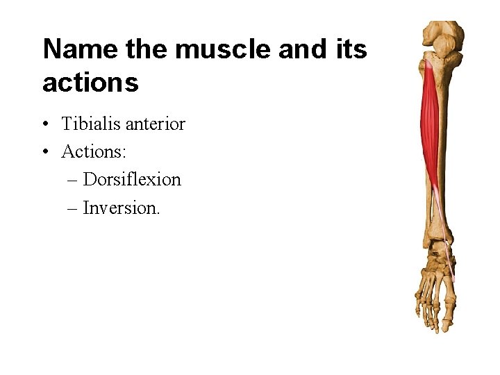 Name the muscle and its actions • Tibialis anterior • Actions: – Dorsiflexion –