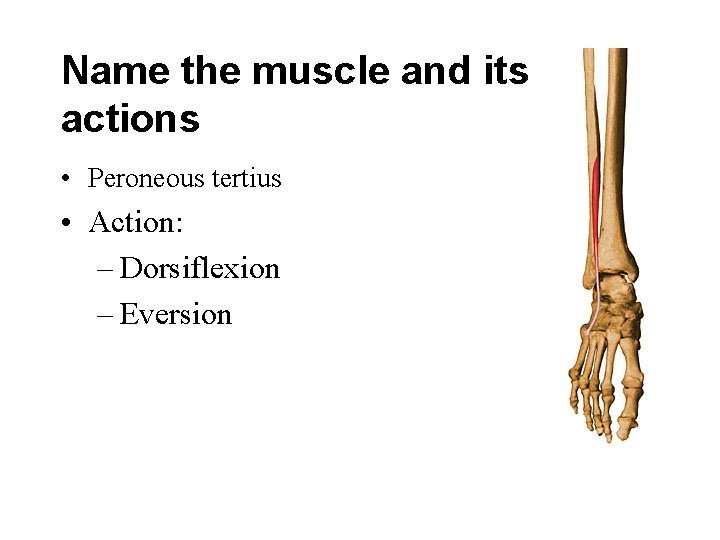 Name the muscle and its actions • Peroneous tertius • Action: – Dorsiflexion –
