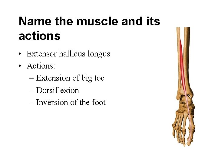 Name the muscle and its actions • Extensor hallicus longus • Actions: – Extension