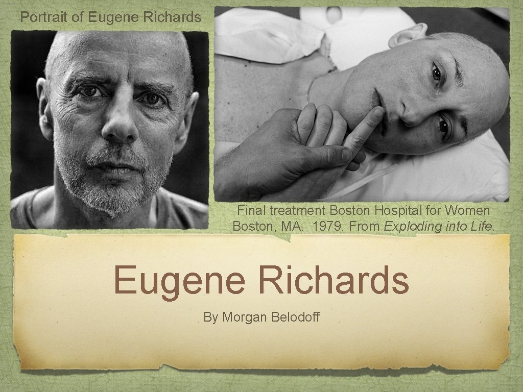Portrait of Eugene Richards Final treatment Boston Hospital for Women Boston, MA. 1979. From