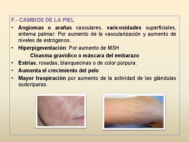 F. - CAMBIOS DE LA PIEL • Angiomas o arañas vasculares, varicosidades superficiales, eritema