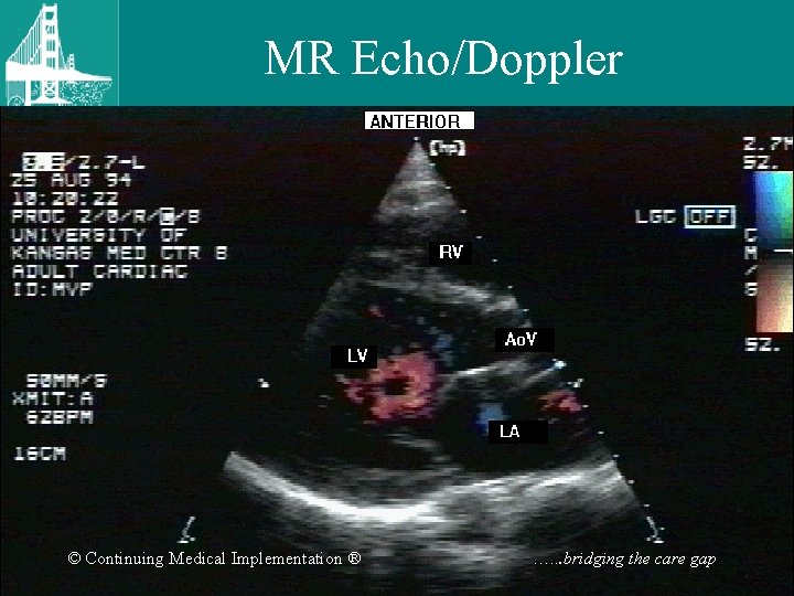 MR Echo/Doppler © Continuing Medical Implementation ® …. . . bridging the care gap