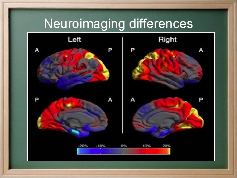 Neuroimaging differences 