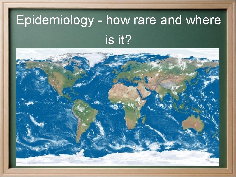 Epidemiology - how rare and where is it? 