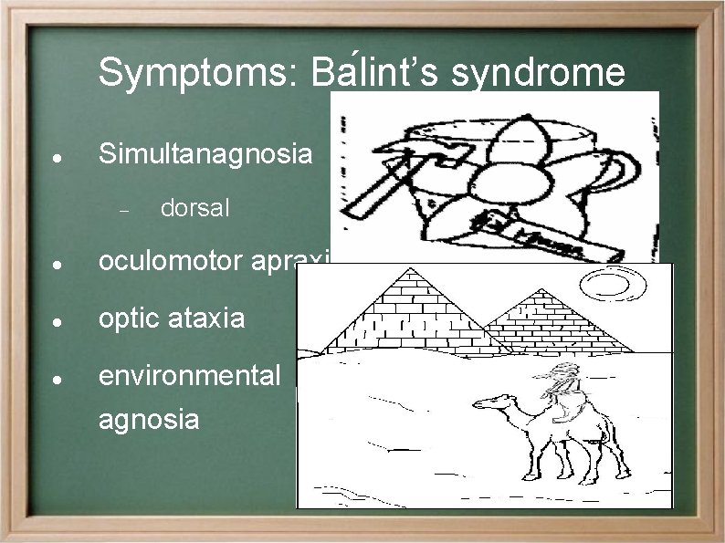 Symptoms: Ba lint’s syndrome Simultanagnosia dorsal oculomotor apraxia optic ataxia environmental agnosia 