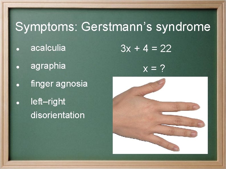 Symptoms: Gerstmann’s syndrome acalculia agraphia finger agnosia left–right disorientation 3 x + 4 =
