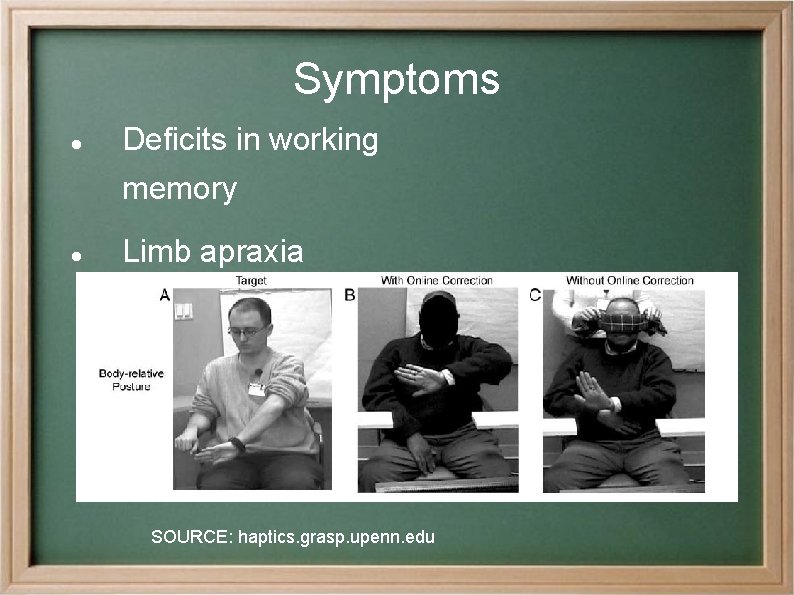 Symptoms Deficits in working memory Limb apraxia SOURCE: haptics. grasp. upenn. edu 