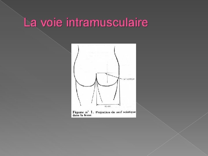 La voie intramusculaire La voie intramusculaire