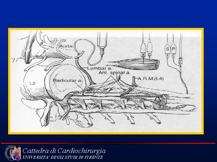 Cattedra di Cardiochirurgia UNIVERSITA’ DEGLI STUDI DI FIRENZE 