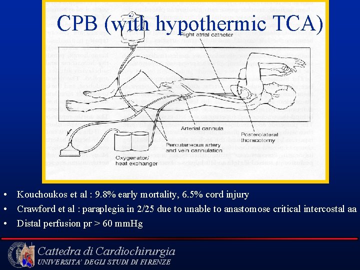  CPB (with hypothermic TCA) • Kouchoukos et al : 9. 8% early mortality,