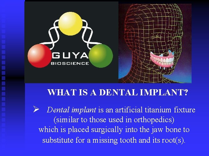 WHAT IS A DENTAL IMPLANT? Ø Dental implant is an artificial titanium fixture (similar