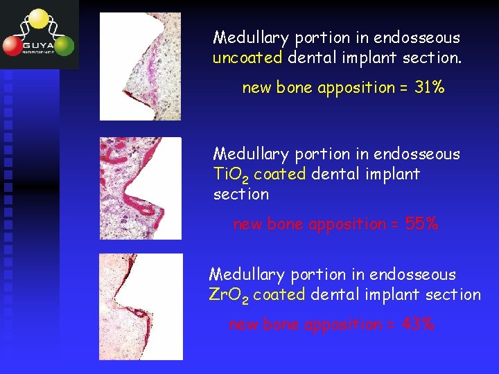 Medullary portion in endosseous uncoated dental implant section. new bone apposition = 31% Medullary