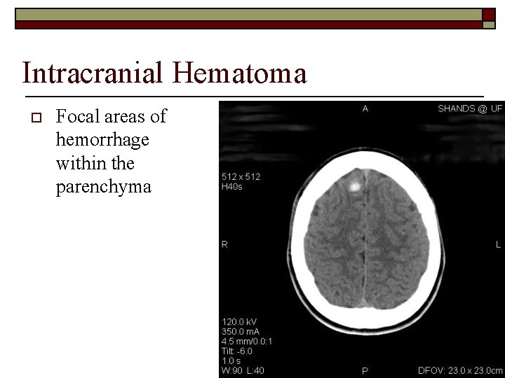 Intracranial Hematoma o Focal areas of hemorrhage within the parenchyma 