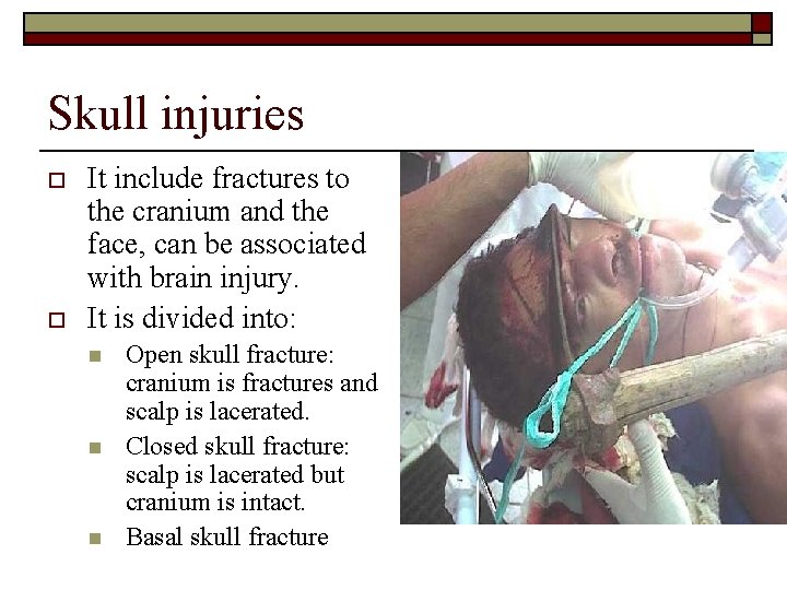 Skull injuries o o It include fractures to the cranium and the face, can