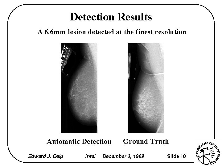 Detection Results A 6. 6 mm lesion detected at the finest resolution Automatic Detection