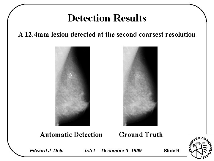 Detection Results A 12. 4 mm lesion detected at the second coarsest resolution Automatic