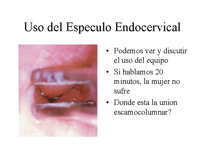 Uso del Especulo Endocervical • Podemos ver y discutir el uso del equipo • Uso del Especulo Endocervical • Podemos ver y discutir el uso del equipo •