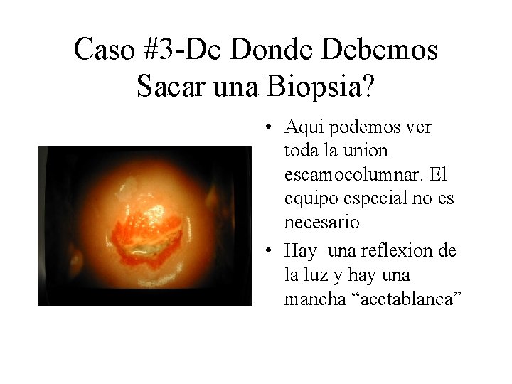 Caso #3 -De Donde Debemos Sacar una Biopsia? • Aqui podemos ver toda la Caso #3 -De Donde Debemos Sacar una Biopsia? • Aqui podemos ver toda la
