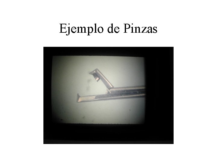 Ejemplo de Pinzas Ejemplo de Pinzas