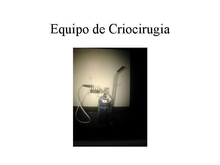 Equipo de Criocirugia Equipo de Criocirugia