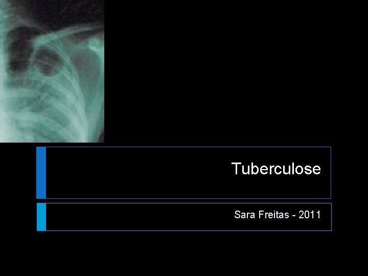 Tuberculose Sara Freitas - 2011 