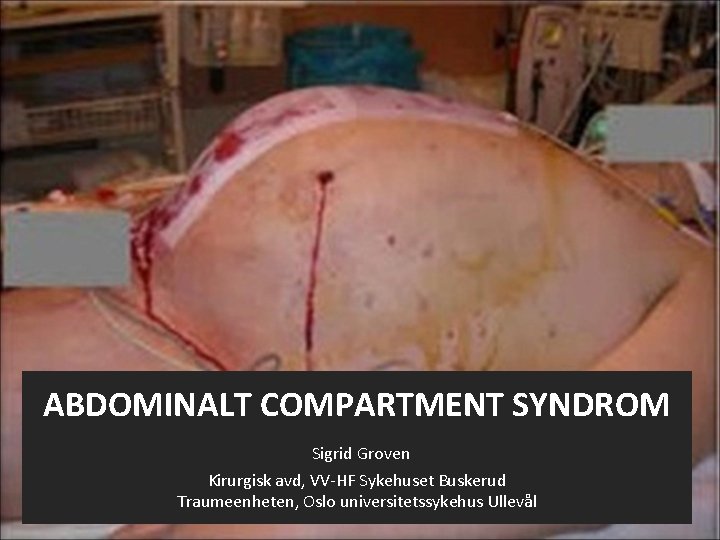 ABDOMINALT COMPARTMENT SYNDROM Sigrid Groven Kirurgisk avd, VV-HF Sykehuset Buskerud Traumeenheten, Oslo universitetssykehus Ullevål