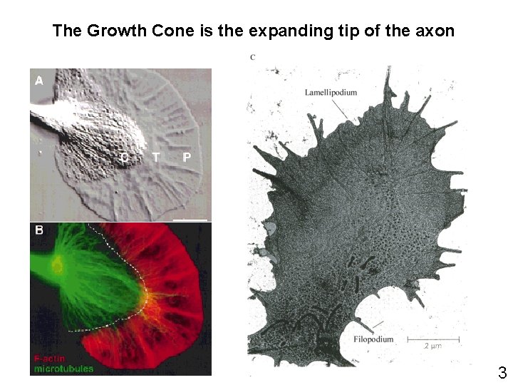 The Growth Cone is the expanding tip of the axon 3 