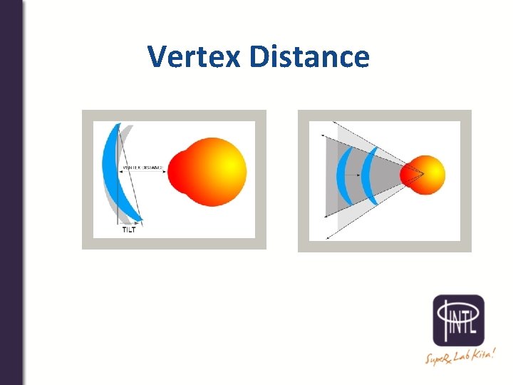 Vertex Distance 