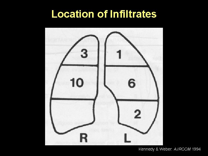 Location of Infiltrates Kennedy & Weber: AJRCCM 1994 