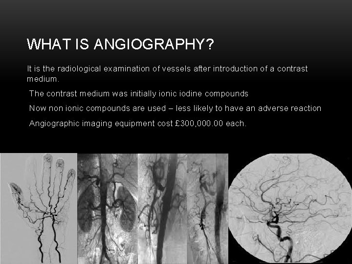 WHAT IS ANGIOGRAPHY? It is the radiological examination of vessels after introduction of a