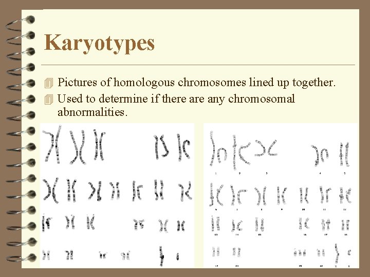 Karyotypes 4 Pictures of homologous chromosomes lined up together. 4 Used to determine if