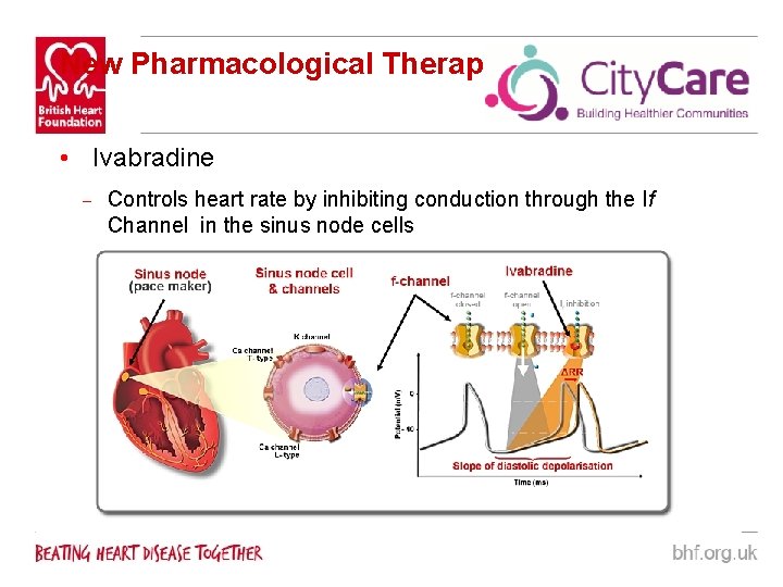 New Pharmacological Therapies • Ivabradine – Controls heart rate by inhibiting conduction through the