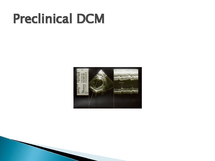 Preclinical DCM 