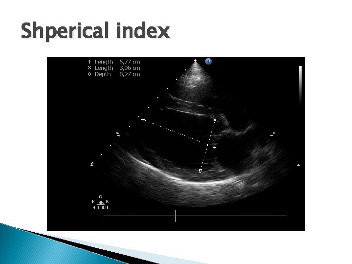 Shperical index 