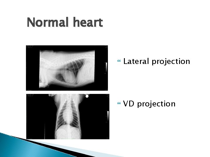 Normal heart Lateral projection VD projection 
