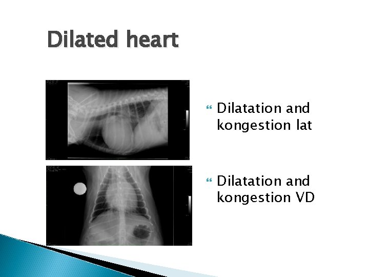 Dilated heart Dilatation and kongestion lat Dilatation and kongestion VD 