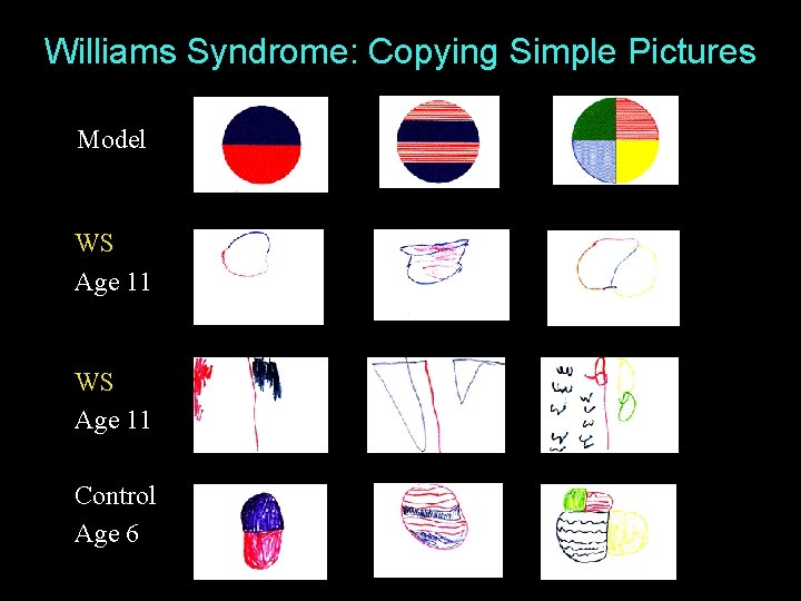 Williams Syndrome: Copying Simple Pictures Model WS Age 11 Control Age 6 