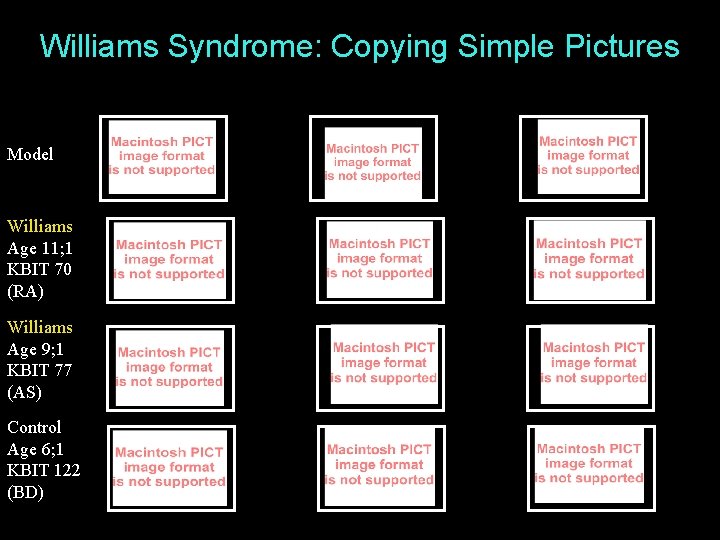 Williams Syndrome: Copying Simple Pictures Model Williams Age 11; 1 KBIT 70 (RA) Williams