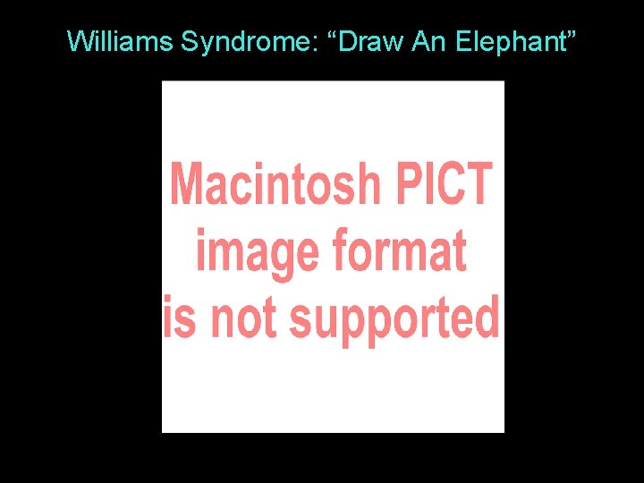 Williams Syndrome: “Draw An Elephant” 